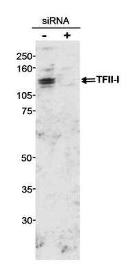 <b>Genetic Strategies Validation. </b>Western Blot: TFII-I Antibody [NB500-157] - Whole cell  lysate (100 ug) from HEK293 cells treated with GTF2I/TFII-I siRNA (+) or untreated (-).  Antibody used at 0.2 ug/ml.