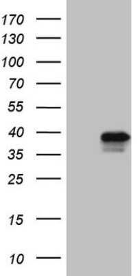 Western Blot: TFIIB Antibody (OTI1H10) - Azide and BSA Free [NBP2-74492] - Analysis of HEK293T cells were transfected with the pCMV6-ENTRY control (Left lane) or pCMV6-ENTRY TFIIB.