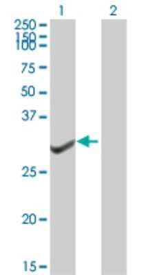 Western Blot: TFIIB Antibody [H00002959-B01P] - Analysis of GTF2B expression in transfected 293T cell line by GTF2B polyclonal antibody.  Lane 1: GTF2B transfected lysate(34.87 KDa). Lane 2: Non-transfected lysate.