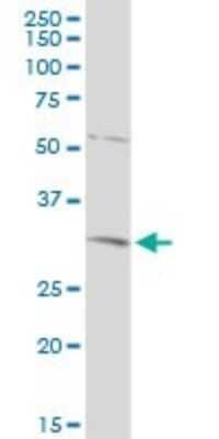 Western Blot: TFIIB Antibody [H00002959-D01P] - Analysis of GTF2B expression in human kidney.