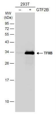 Western Blot TFIIB Antibody