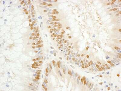 Immunohistochemistry-Paraffin TFIIE-alpha Antibody - BSA Free