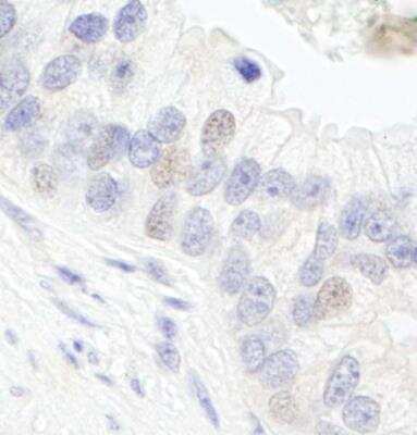 Immunohistochemistry-Paraffin TFIIIC Antibody