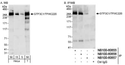 Western Blot TFIIIC Antibody