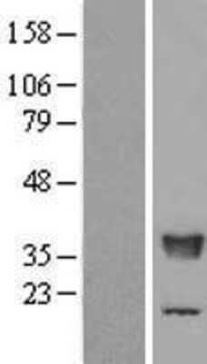 Western Blot TFIIS Overexpression Lysate