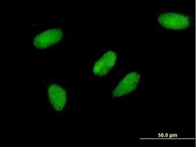 Immunocytochemistry/Immunofluorescence: TFIISH Antibody (2C9) [H00006920-M06] - Analysis of monoclonal antibody to TCEA3 on HeLa cell. Antibody concentration 10 ug/ml