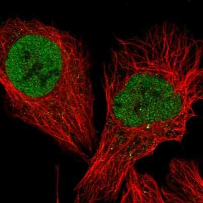 Immunocytochemistry/Immunofluorescence: TFIISH Antibody [NBP2-58254] - Staining of human cell line U-2 OS shows localization to nucleoplasm.