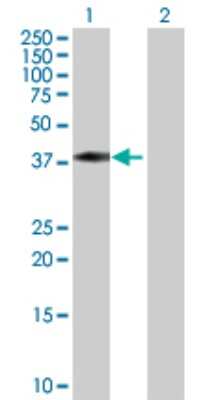Western Blot: TFIISH Antibody [H00006920-D01P] - Analysis of TCEA3 expression in transfected 293T cell line by TCEA3 polyclonal antibody.Lane 1: TCEA3 transfected lysate(39.00 KDa).Lane 2: Non-transfected lysate.