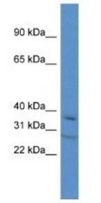 Western Blot: TFIISH Antibody [NBP1-91318] - Mouse Thymus Lysate 1ug/ml Gel Concentration 12%