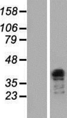 Western Blot TFIISH Overexpression Lysate