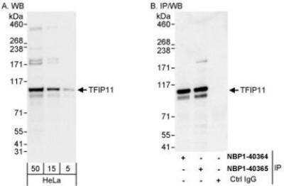 Western Blot: TFIP11 Antibody [NBP1-40365] - Whole cell lysate (5, 15 and 50 mcg for WB; 1 mg for IP, 20% of IP loaded) from HeLa cells.  Antibodies: Affinity purified rabbit anti-TFIP11 antibody  used for WB at 0.04 mcg/ml (A) and 1 mcg/ml (B) and used for IP at 3 mcg/mg lysate.  TFIP11 was also immunoprecipitated by rabbit anti-TFIP11 antibody NBP1-40364which recognizes an upstream epitope.