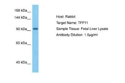 Western Blot: TFIP11 Antibody [NBP2-86860] - Host: Rabbit. Target Name: TFP11. Sample Type: Fetal Liver lysates. Antibody Dilution: 1.0ug/ml