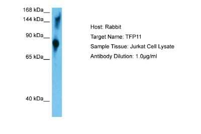 Western Blot: TFIP11 Antibody [NBP2-86861] - Host: Rabbit. Target Name: TFP11. Sample Type: Jurkat Whole Cell. Antibody Dilution: 1.0ug/ml