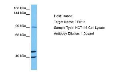 Western Blot: TFIP11 Antibody [NBP2-86862] - Host: Rabbit. Target Name: TFIP11. Sample Tissue: Human HCT116 Whole Cell lysates. Antibody Dilution: 1ug/ml