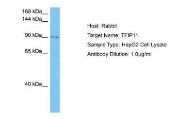 Western Blot: TFIP11 Antibody [NBP2-86863] - Host: Rabbit. Target Name: TFIP11. Sample Tissue: Human HepG2 Whole Cell lysates. Antibody Dilution: 1ug/ml