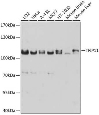 Western Blot: TFIP11 Antibody [NBP2-93034] - Analysis of extracts of various cell lines, using TFIP11 at 1:1000 dilution. Secondary antibody: HRP Goat Anti-Rabbit IgG (H+L) at 1:10000 dilution. Lysates/proteins: 25ug per lane. Blocking buffer: 3% nonfat dry milk in TBST. Detection: ECL Basic Kit . Exposure time: 10s.