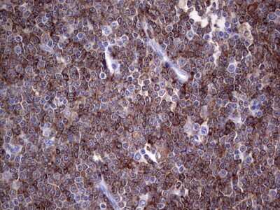 Immunohistochemistry: TFPI-2 Antibody (1D4) [NBP2-46100] - Analysis of Human lymphoma tissue. (Heat-induced epitope retrieval by 1 mM EDTA in 10mM Tris, pH8.5, 120C for 3min)