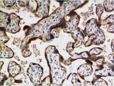 Immunohistochemistry-Paraffin: TFPI-2 Antibody (MM0564-9F6) [NBP2-11918] - 10% Buffer formalin fixed and parffine embedded human placental tissue section (4um) is subjected IHC staining using NBP2-11918. Tissue section was pretreated in citric buffer (ph6.0) with microwave for antige retrieval before IHC is applied.   