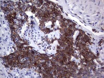 Immunohistochemistry: TFPI-2 Antibody (OTI1D4) - Azide and BSA Free [NBP2-74494] - Analysis of Human lymph node tissue. (Heat-induced epitope retrieval by 1 mM EDTA in 10mM Tris, pH8.5, 120C for 3min)