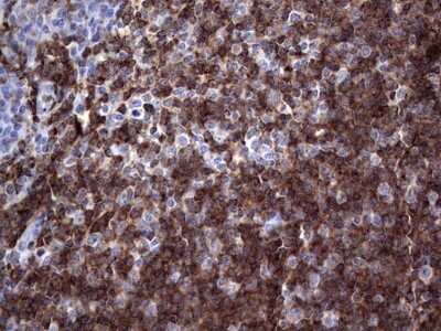 Immunohistochemistry: TFPI-2 Antibody (OTI1D4) - Azide and BSA Free [NBP2-74494] - Analysis of Human tonsil tissue. (Heat-induced epitope retrieval by 1 mM EDTA in 10mM Tris, pH8.5, 120C for 3min)