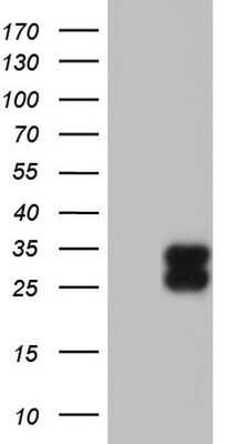 Western Blot: TFPI-2 Antibody (OTI1D4) - Azide and BSA Free [NBP2-74494] - Analysis of HEK293T cells were transfected with the pCMV6-ENTRY control (Left lane) or pCMV6-ENTRY TFPI-2.