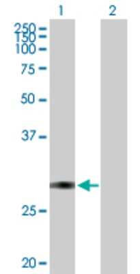 Western Blot: TFPI-2 Antibody [H00007980-B01P] - Analysis of TFPI2 expression in transfected 293T cell line by TFPI2 polyclonal antibody.  Lane 1: TFPI2 transfected lysate(25.85 KDa). Lane 2: Non-transfected lysate.