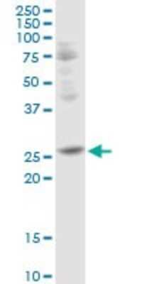 Western Blot: TFPI-2 Antibody [H00007980-D01P] - Analysis of TFPI2 expression in HepG2.