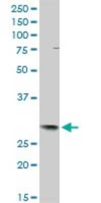 Western Blot: TFPI-2 Antibody [H00007980-D01P] - Analysis of TFPI2 expression in human placenta.