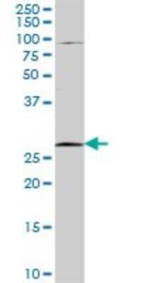 Western Blot: TFPI-2 Antibody [H00007980-D01P] - Analysis of TFPI2 expression in mouse kidney.
