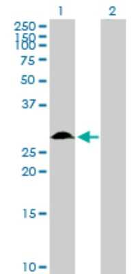 Western Blot: TFPI-2 Antibody [H00007980-D01P] - Analysis of TFPI2 expression in transfected 293T cell line by TFPI2 polyclonal antibody.Lane 1: TFPI2 transfected lysate(26.90 KDa).Lane 2: Non-transfected lysate.