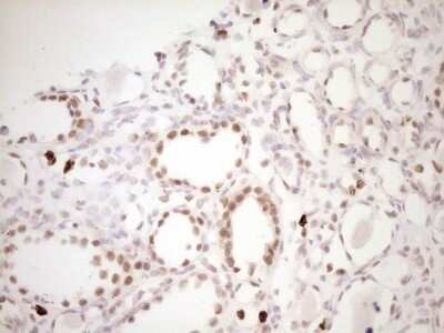 Immunohistochemistry: TFPI Antibody (OTI5H5) - Azide and BSA Free [NBP2-74493] - Analysis of Human Kidney tissue. (Heat-induced epitope retrieval by 1 mM EDTA in 10mM Tris, pH8.5, 120C for 3min)