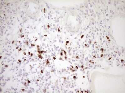 Immunohistochemistry: TFPI Antibody (OTI5H5) - Azide and BSA Free [NBP2-74493] - Analysis of Human thyroid tissue. (Heat-induced epitope retrieval by 1 mM EDTA in 10mM Tris, pH8.5, 120C for 3min)