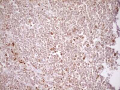 Immunohistochemistry: TFPI Antibody (OTI5H5) - Azide and BSA Free [NBP2-74493] - Analysis of Human tonsil tissue. (Heat-induced epitope retrieval by 1 mM EDTA in 10mM Tris, pH8.5, 120C for 3min)