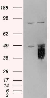 Western Blot: TFPI Antibody [NB100-786] - HEK293 overexpressing TFPI and probed with (mock transfection in first lane).