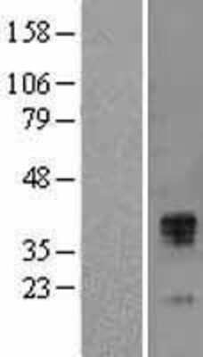 Western Blot TFPI Overexpression Lysate