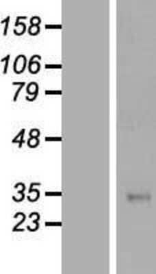 Western Blot TFPI Overexpression Lysate