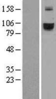 Western Blot TfR2 Overexpression Lysate