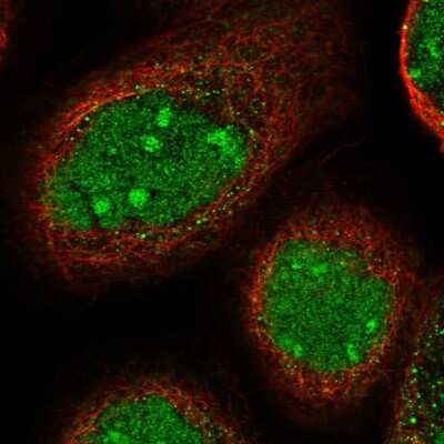 Immunocytochemistry/Immunofluorescence: TGDS Antibody [NBP1-87063] - Immunofluorescent staining of human cell line A-431 shows localization to nucleus & nucleoli.