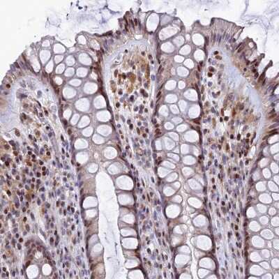 Immunohistochemistry-Paraffin: TGDS Antibody [NBP1-87063] - Staining of human rectum shows moderate nuclear positivity in glandular cells.