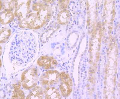 Immunohistochemistry-Paraffin: TGF-alpha Antibody (JB58-36) [NBP2-75682] - Analysis of paraffin-embedded human kidney tissue using anti-TGF alpha antibody. Counter stained with hematoxylin.