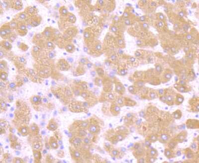 Immunohistochemistry-Paraffin: TGF-alpha Antibody (JB58-36) [NBP2-75682] - Analysis of paraffin-embedded human liver tissue using anti-TGF alpha antibody. Counter stained with hematoxylin.