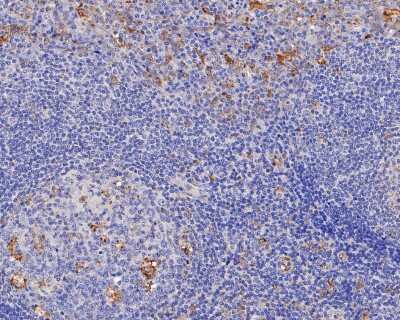 Immunohistochemistry-Paraffin: TGF-alpha Antibody (JB58-36) [NBP2-75682] - Immunohistochemical analysis of paraffin-embedded human tonsil tissue using anti-TGF-alpha antibody. Counter stained with hematoxylin.