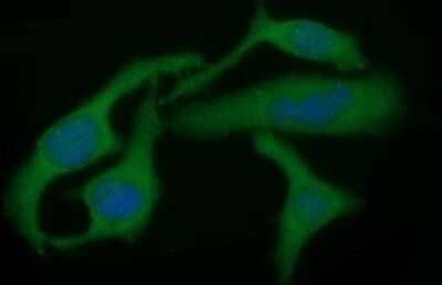 Immunocytochemistry/Immunofluorescence: TGF-beta 1 Antibody (OTI1E12) - Azide and BSA Free [NBP2-74495] - Analysis of HeLa cells.