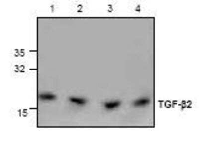 Western Blot: TGF-beta 2 Antibody [NBP1-45892] - Analysis of  TGF-beta 2 using Jurkat cell lysate (Lane 1,2), Mouse 3T3 cell lysate (Lane 3) and Rat kidney tissue lysate (Lane 4).