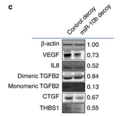 Western Blot: TGF-beta 2 Antibody [NBP1-45892] - Inhibition of miR-10b suppresses angiogenesis by U87-2M1 glioma cells. Downregulation of expression of pro-angiogenic proteins in U87-2M1 cells by miR-10b decoy as demonstrated in western blotting analysis. Numbers indicate relative protein expression in miR-10b decoy-treated U87-2M1 cells compared with control decoy-transduced U87-2M1 cells after normalization to beta-actin levels. Blots shown are representative of biological triplicates.  Image collected and cropped by CiteAb from the following publication (//www.nature.com/doifinder/10.1038/cddis.2012.134), licensed under a CC-BY license.