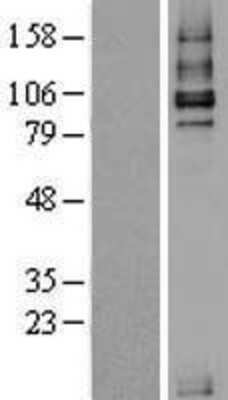 Western Blot: TGF beta Receptor III Overexpression Lysate (Adult Normal) [NBL1-16858] Left-Empty vector transfected control cell lysate (HEK293 cell lysate); Right -Over-expression Lysate for TGF beta Receptor III.