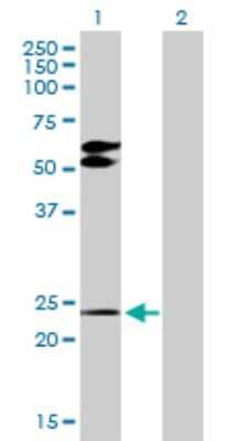 Western Blot: TGF beta induced factor 2 Antibody [H00060436-D01P] - Analysis of TGIF2 expression in transfected 293T cell line by TGIF2 polyclonal antibody.Lane 1: TGIF2 transfected lysate(25.90 KDa).Lane 2: Non-transfected lysate.