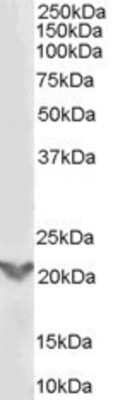 Western Blot: TGF beta induced factor 2 Antibody [NB600-803] - (0.3ug/ml) staining of A431 lysate (35ug protein in RIPA buffer). Primary incubation was 1 hour. Detected by chemiluminescence.
