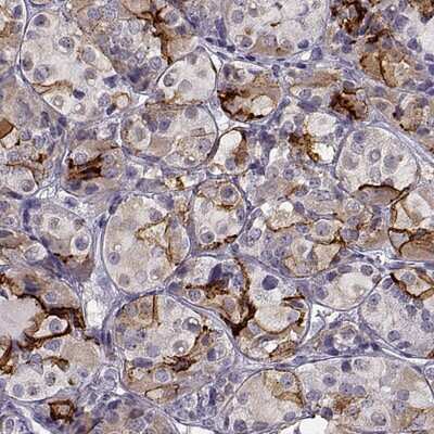 Immunohistochemistry-Paraffin: TGFBR3L Antibody [NBP2-57581] - Staining of human pituitary gland shows strong cytoplasmic and membranous positivity in anterior lobe.