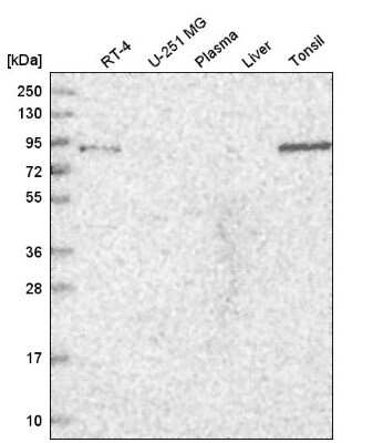 Western Blot TGFBRAP1 Antibody